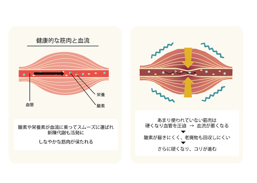 首の痛み・肩こり
