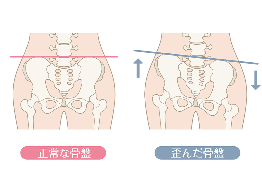 産後の腰痛